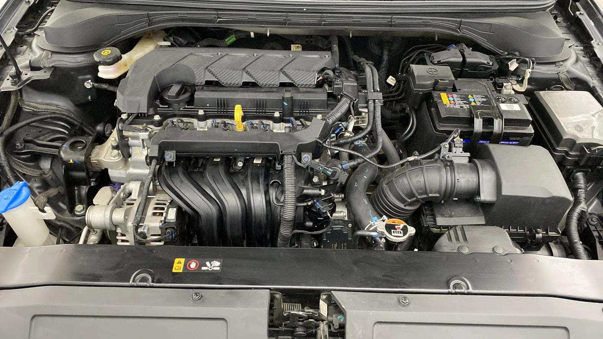 Engine bay of a Hyundai Verna