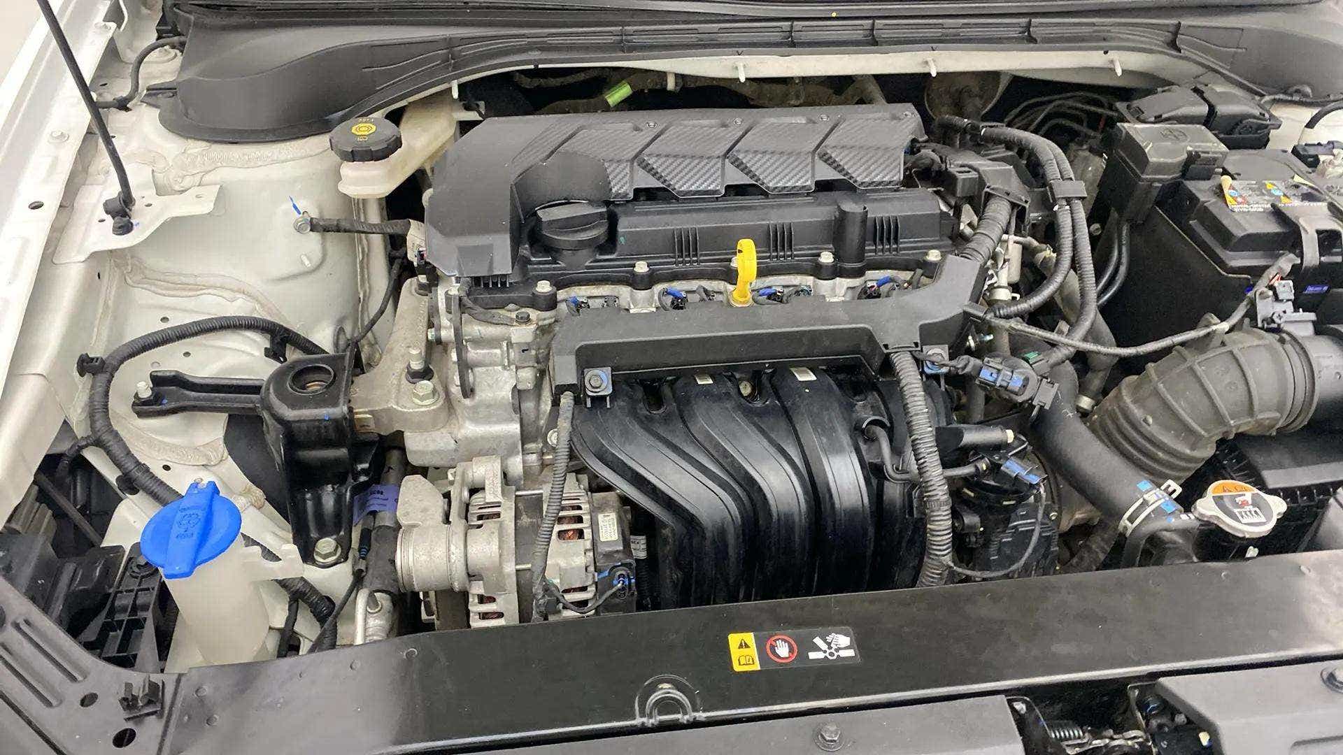 Engine bay view of a Hyundai Verna